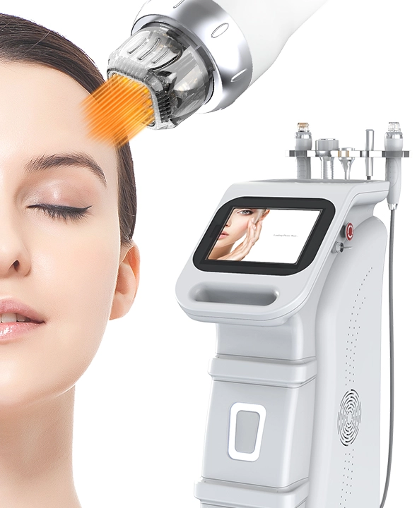 Benefits of Vacuum RF Microneedling