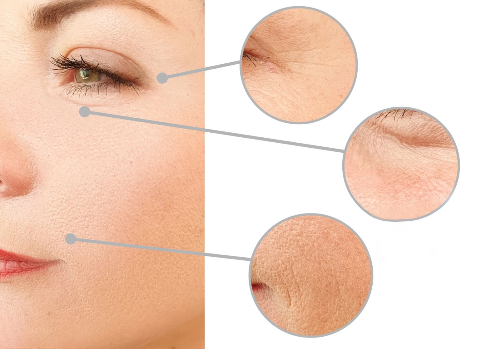 How Long Does Micro Needling Take?