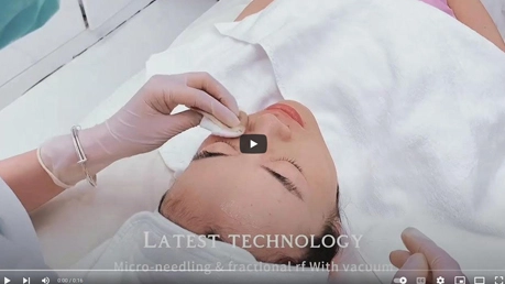 Video Of Portable Vacuum Microneedling RF Machine