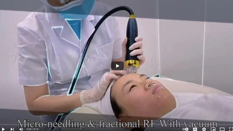 Video Of Vertical Vacuum Microneedling RF Machine