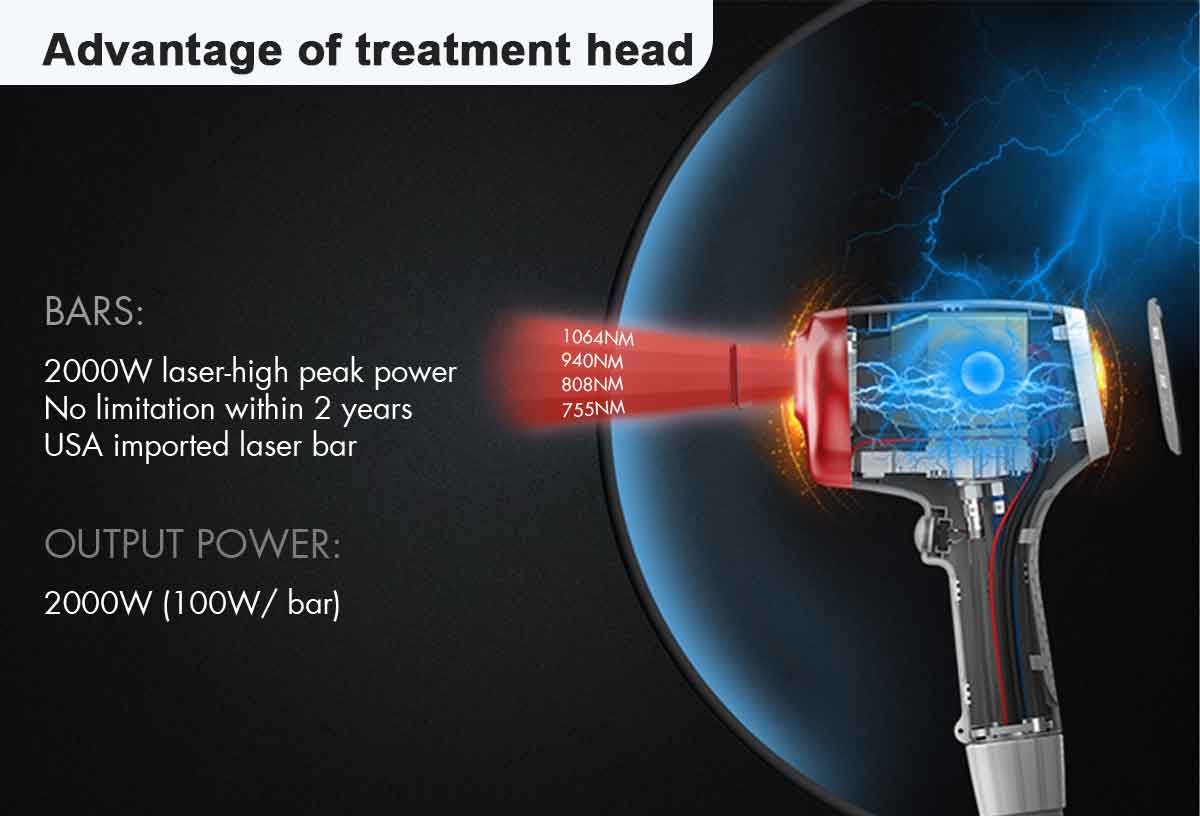 advantages of 4-wavelength diode laser hair removal machine