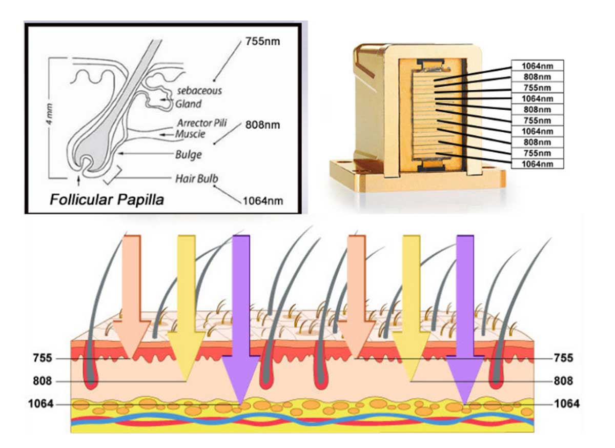 triple-wavelength-diode-laser-price