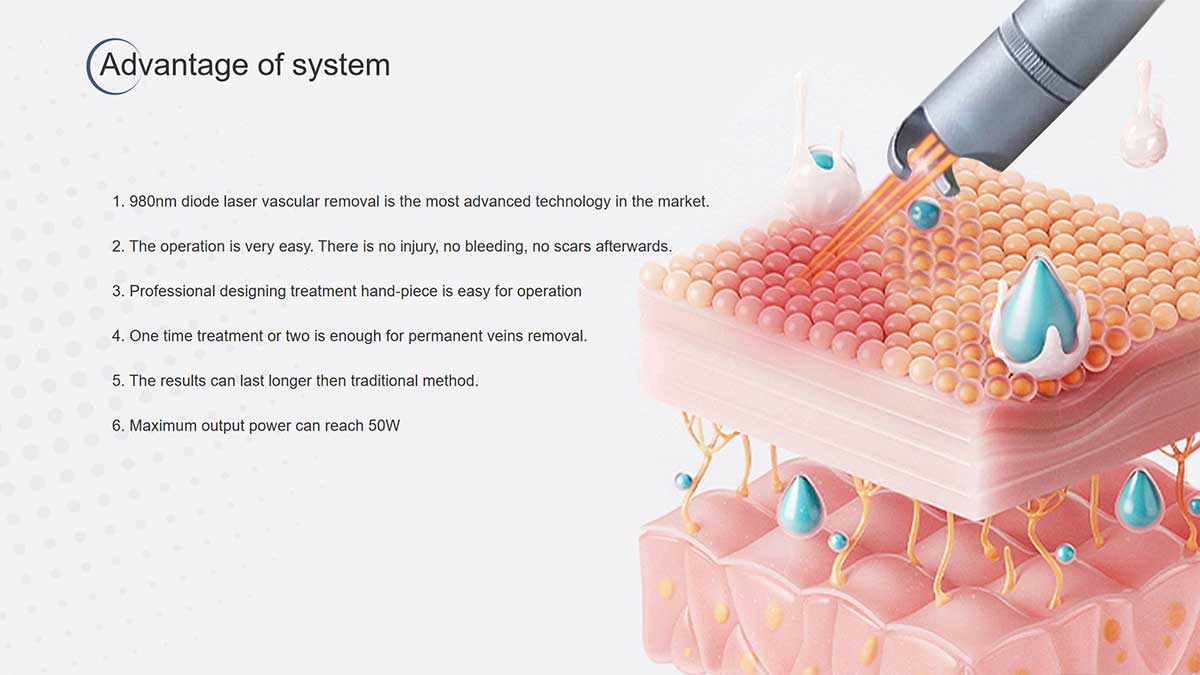 Laser Spider Vein Removal Machine of Suppliers