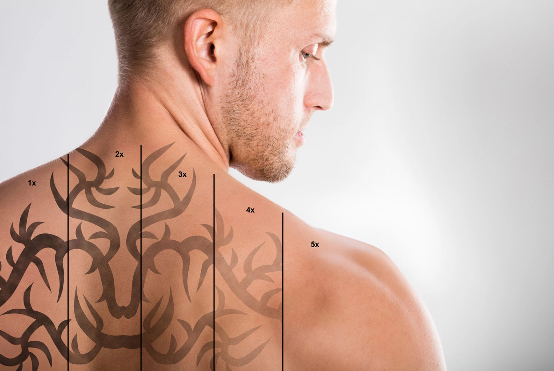 Tattoo and Pigmentation Removal Treatment Solution with Picosecond Laser Technology