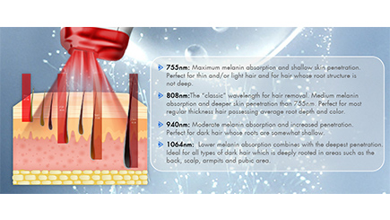 The_role_of_different_wavelengths_of_the_808_diode_laser_removal_machine_handle-04.jpg