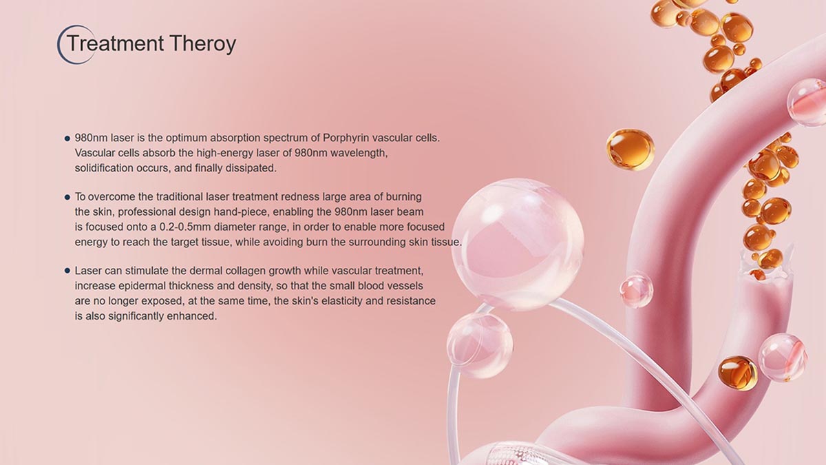 Understanding_the_Precision_and_Safety_of_the_980nm_Diode_Laser_Vascular_Removal_Machine-2.jpg