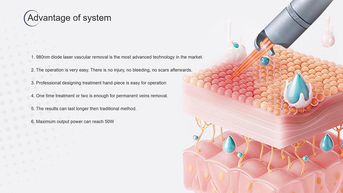 Understanding_the_Precision_and_Safety_of_the_980nm_Diode_Laser_Vascular_Removal_Machine-4.jpg