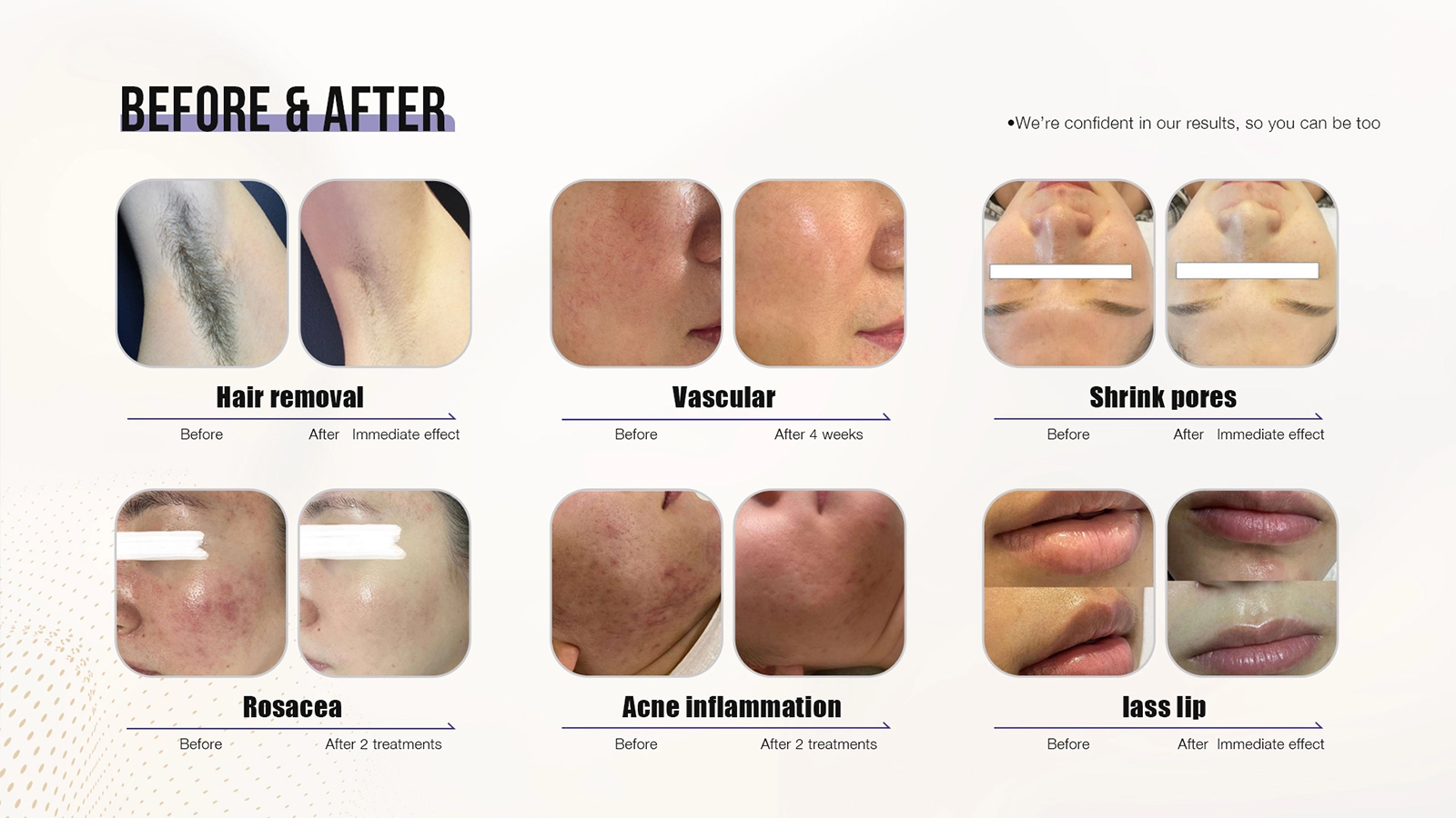 Impressive Laser Skin Rejuvenation Before and After Outcomes and Essential Aftercare Tips